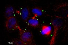 Hep-2 signal activated cells. Image by Dr. Vassilis Doucas.